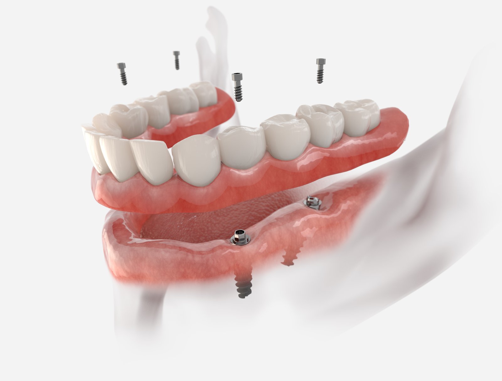 Dentures Photo