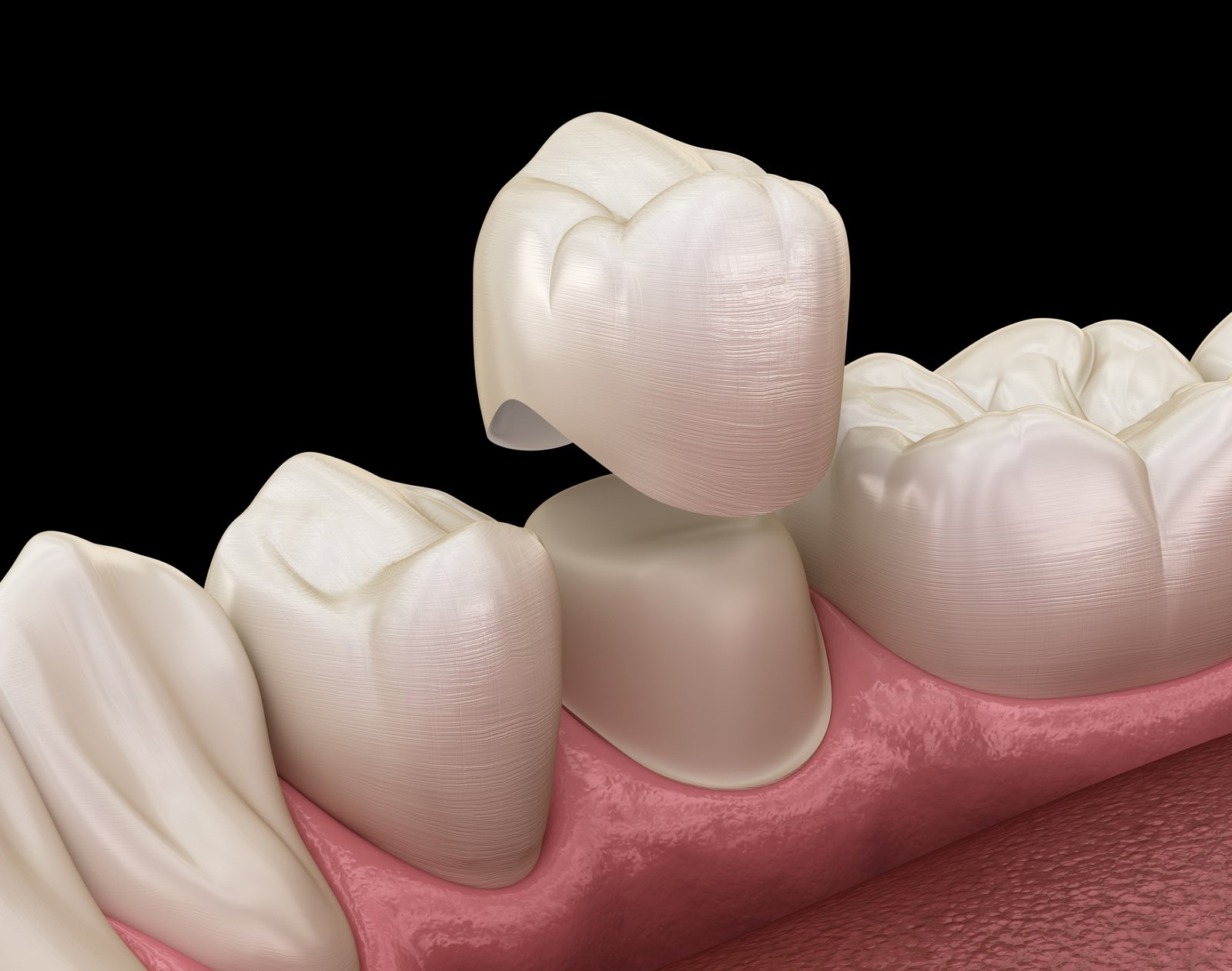 Restorative Dentistry in Angier NC