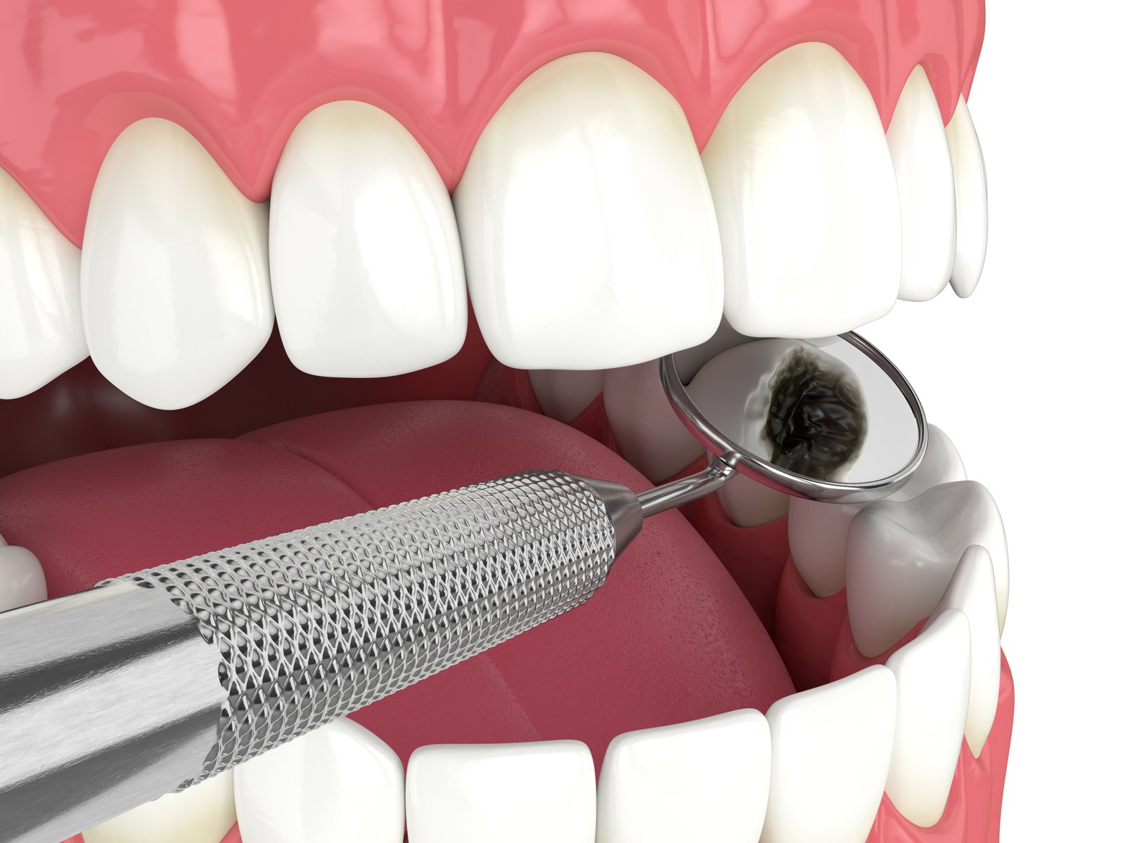 Dental Services in Angier NC