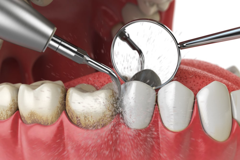 How to Know If Your Gum Issues Need a Periodontist Visit