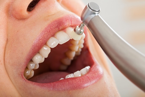 Seasonal Tooth Sensitivity After Cleanings in Angier