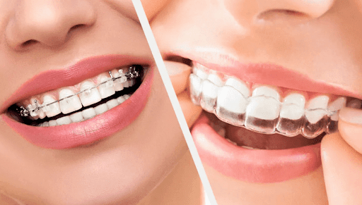 Understanding TMJ Disorder: Symptoms, Causes, and Treatment Options