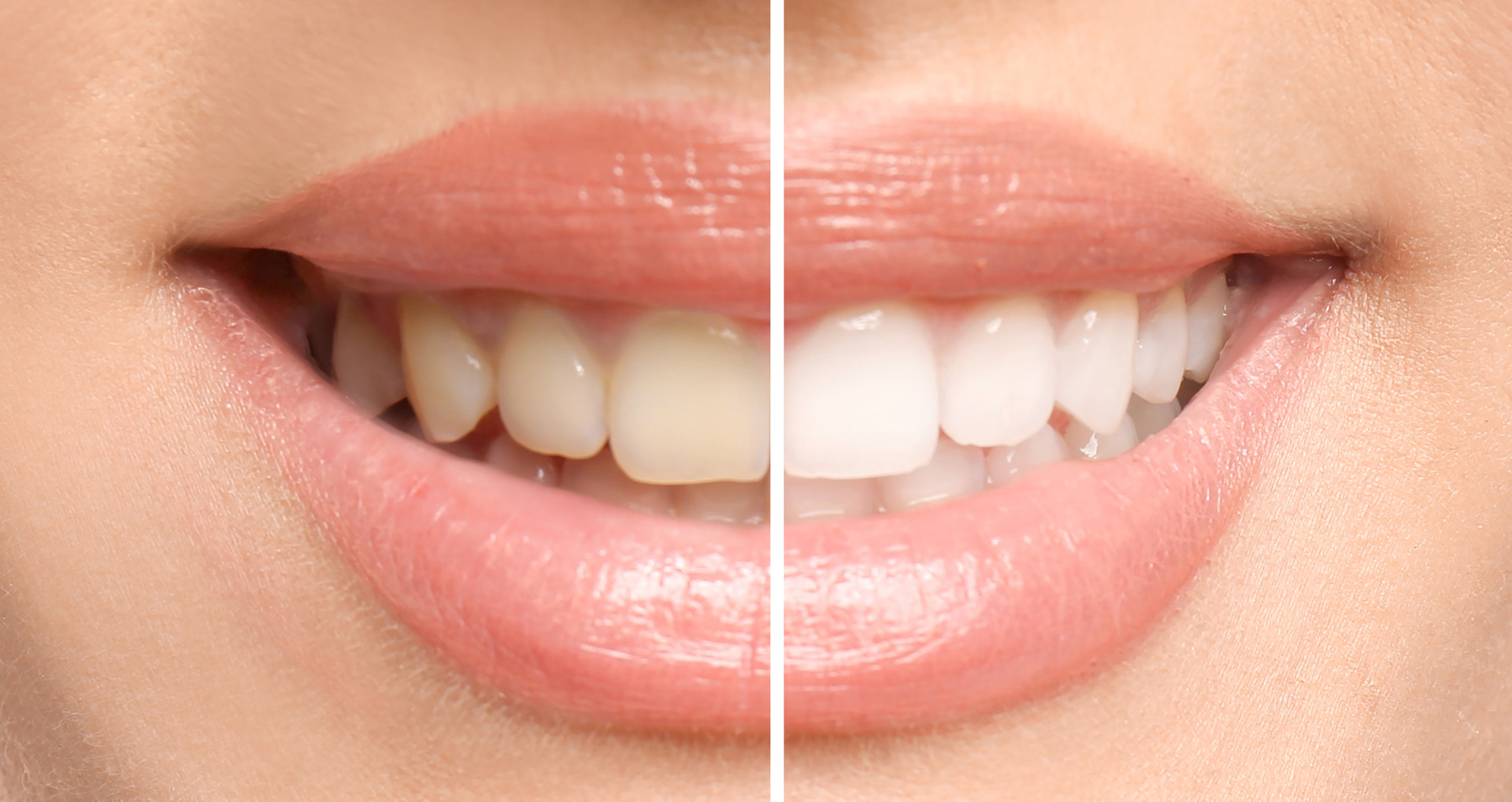 Recognizing Dental Emergencies That Need an Angier Dentist