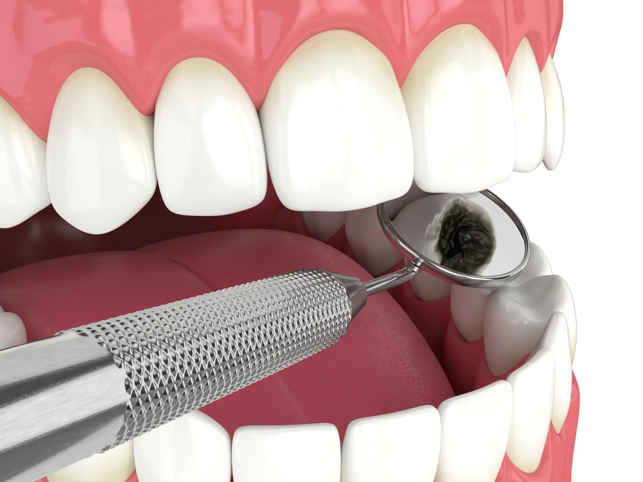 Preventive Dental Care in Angier NC